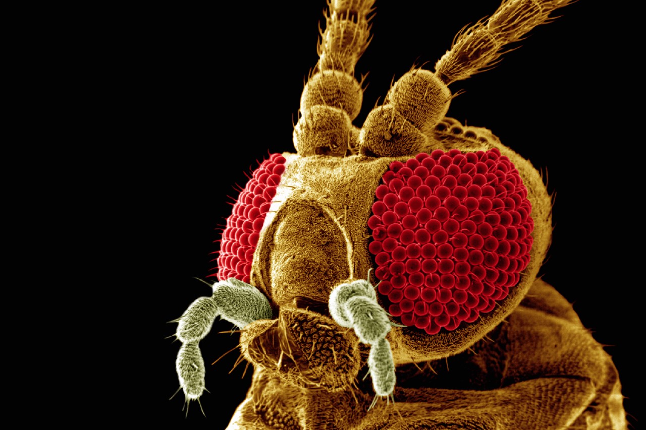 x 0030-Cabeza de larva de Hydropsyche angustipennis