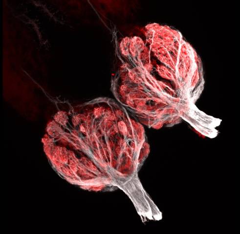 x 0250-Olfactory bulbs