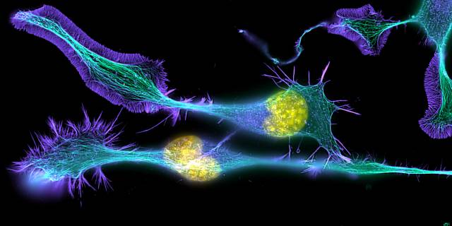 x 1000-Differentiating neuronal cells actin, microtubules and DNA