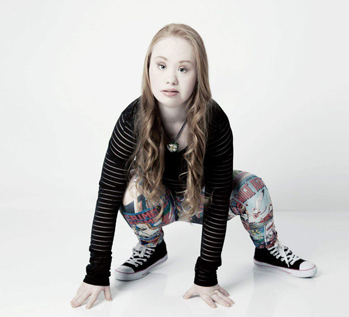 Madeline Stuart sindrome de down Down Syndrome2