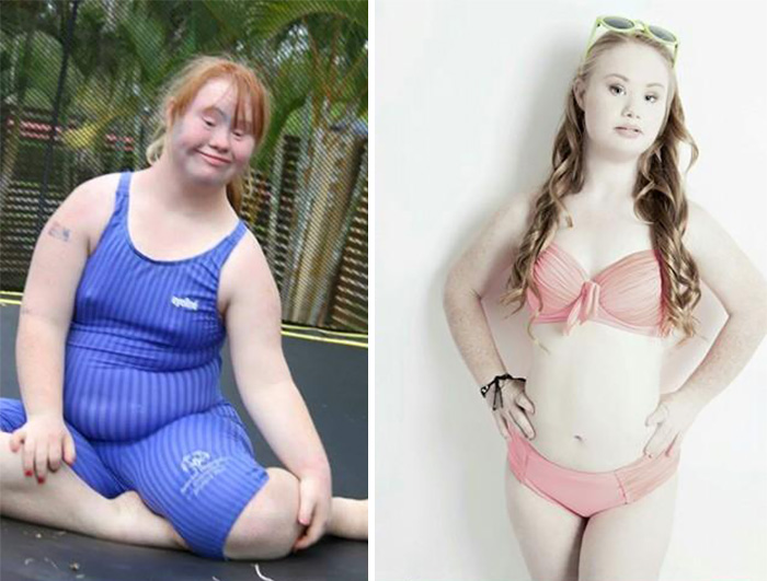 Madeline Stuart sindrome de down Down Syndrome3
