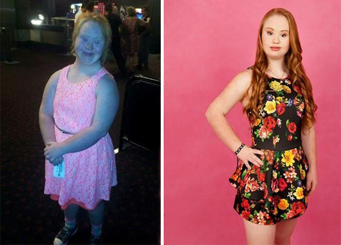Madeline Stuart sindrome de down Down Syndrome6
