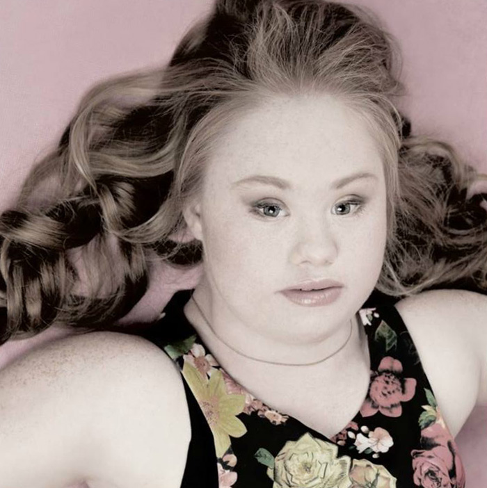 Madeline Stuart sindrome de down Down Syndrome7