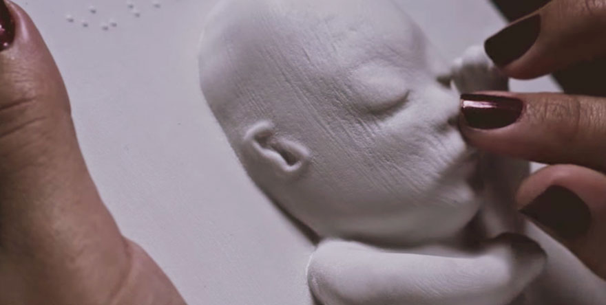 mujer ciega embarazada ecografia 3D 3