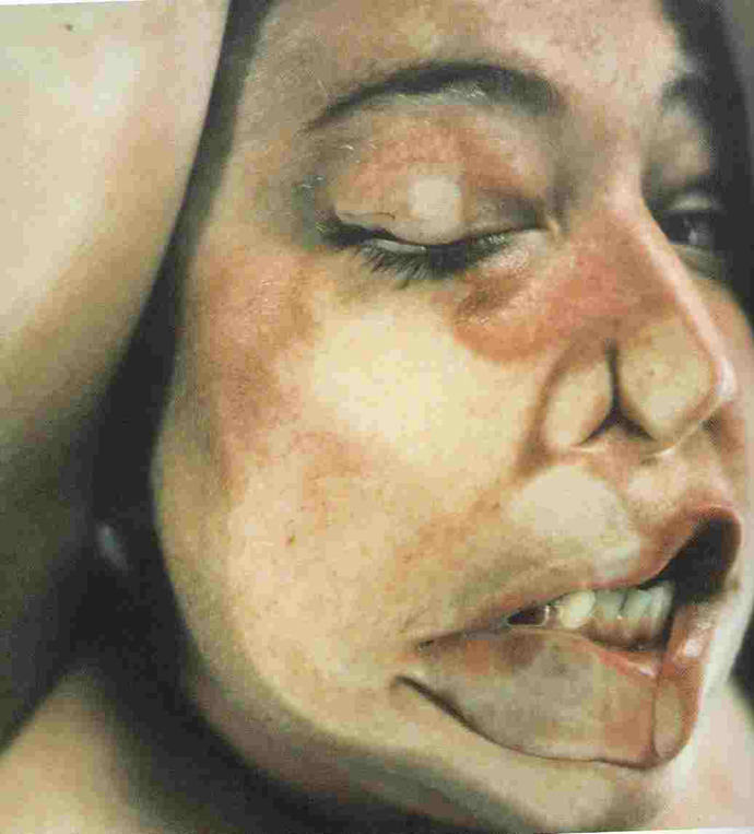 Closed Contact Jenny Saville Cultura Inquieta7