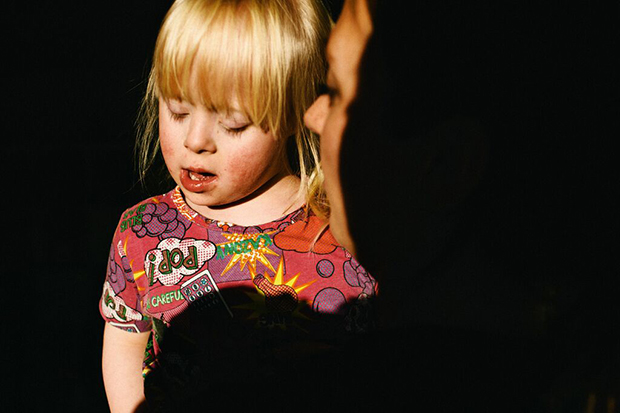 Sindrome de Down Down Syndrome Mario Wezel3