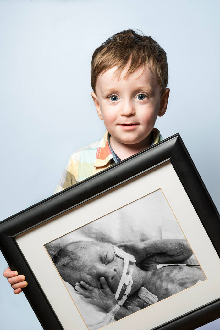 Premature Babies bebe prematuro