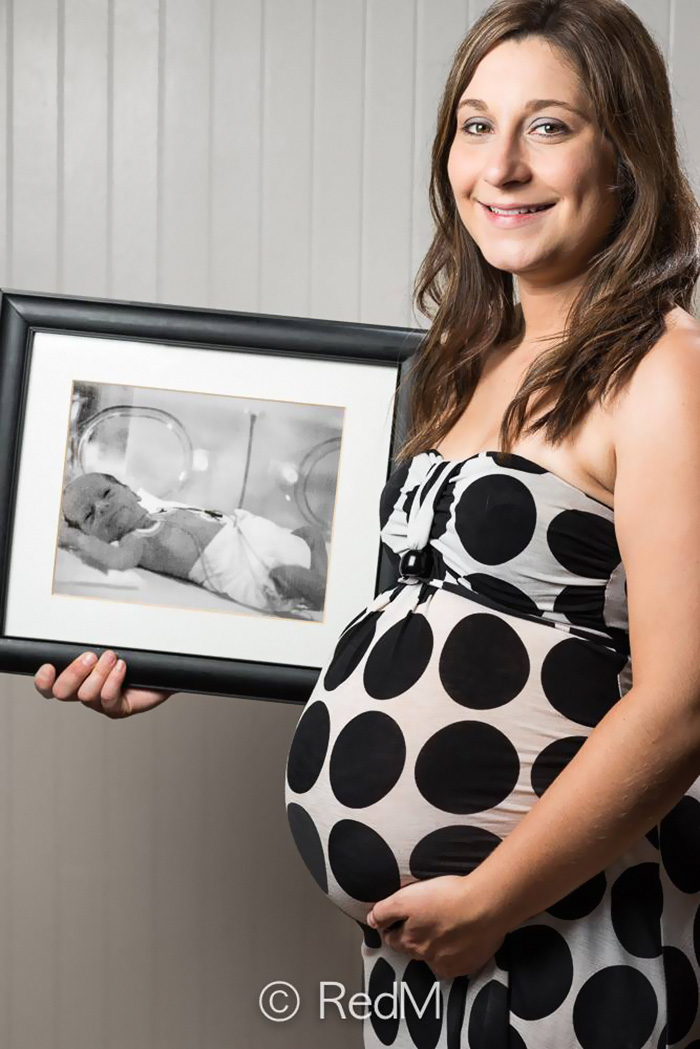 Premature Babies bebe prematuro10