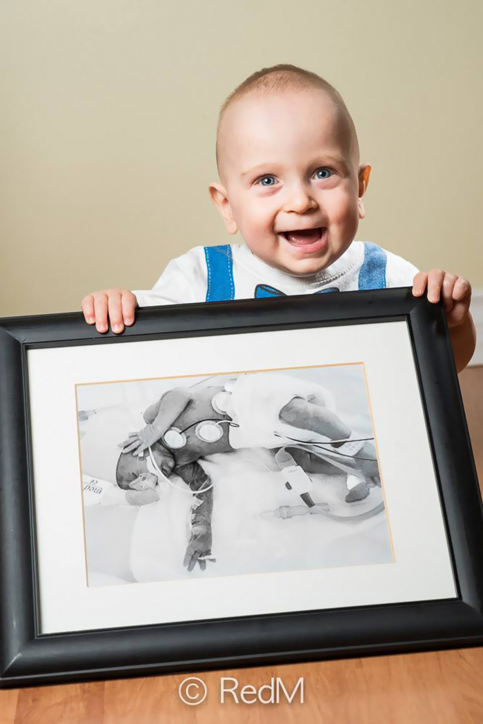 Premature Babies bebe prematuro13