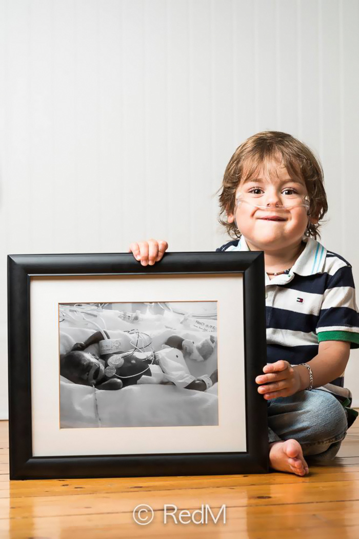 Premature Babies bebe prematuro4