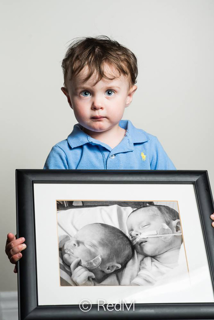 Premature Babies bebe prematuro5