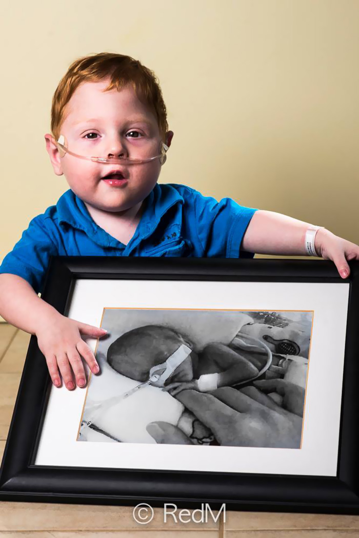 Premature Babies bebe prematuro9
