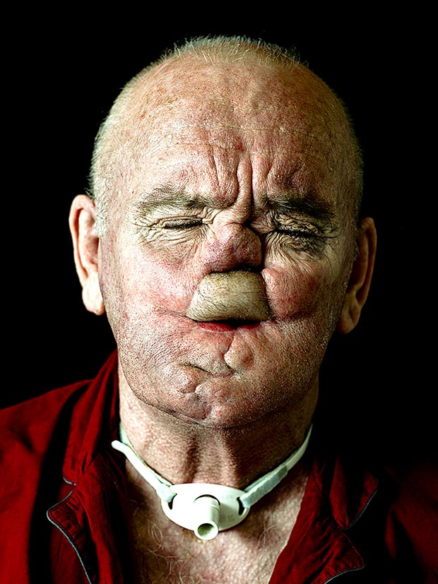 rostros desfigurados Disfiguration Portraits Cyril Crepin12