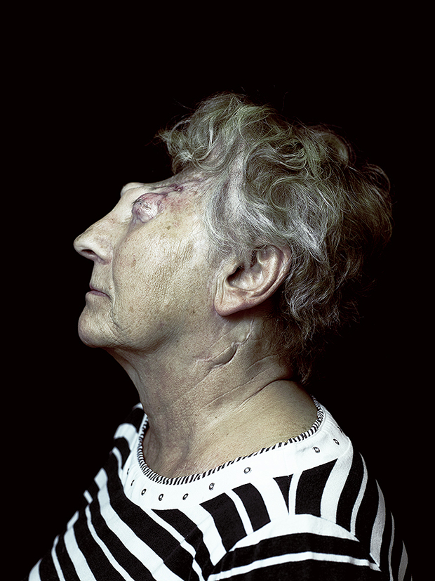 rostros desfigurados Disfiguration Portraits Cyril Crepin2