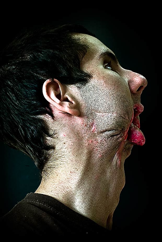 rostros desfigurados Disfiguration Portraits Cyril Crepin5