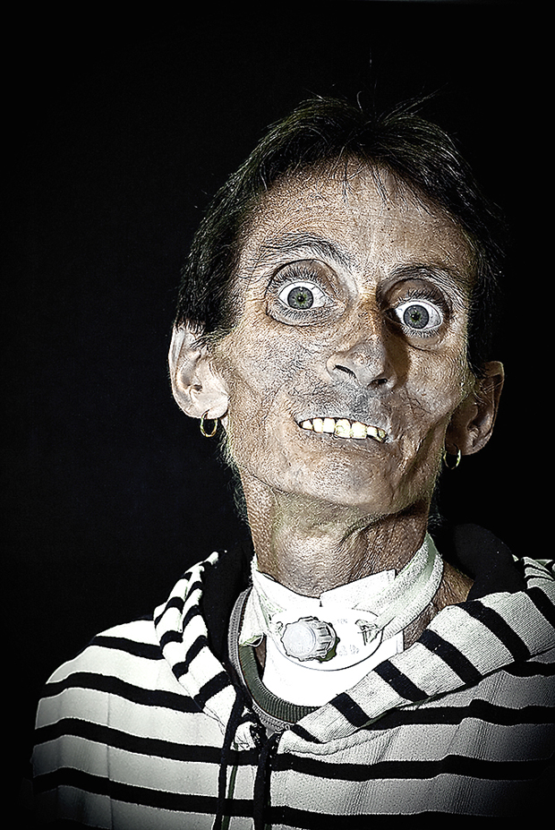 rostros desfigurados Disfiguration Portraits Cyril Crepin6