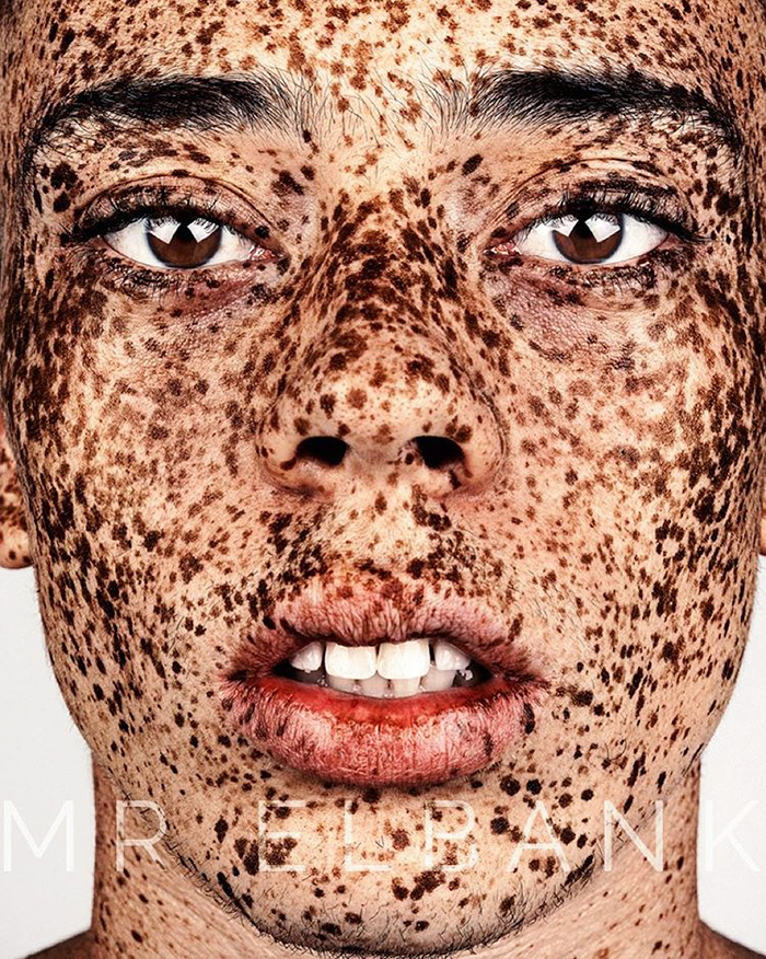 Brock Elbank freckles beauty12