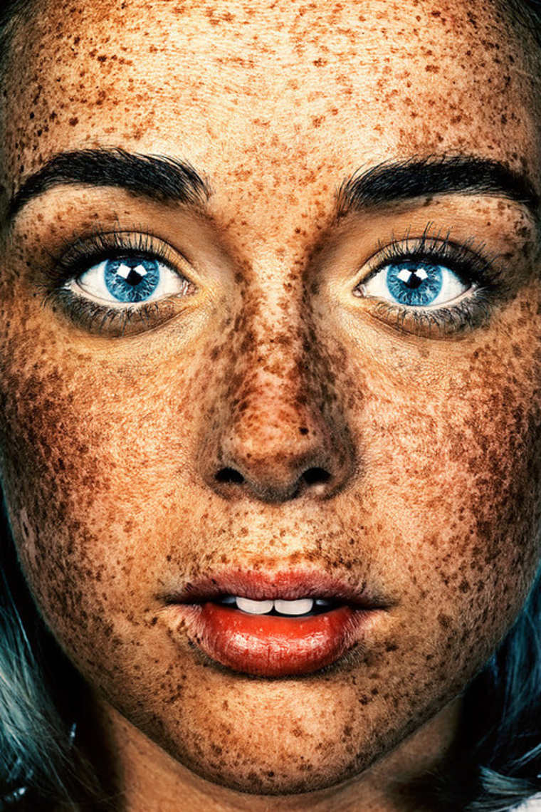 Brock Elbank freckles beauty20