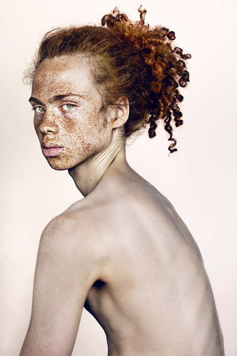 Brock Elbank freckles beauty21