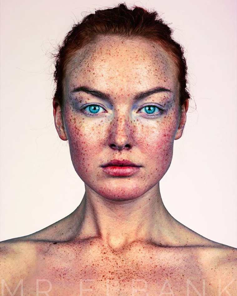 Brock Elbank freckles beauty24