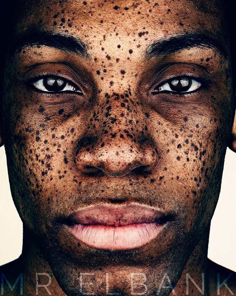 Brock Elbank freckles beauty25