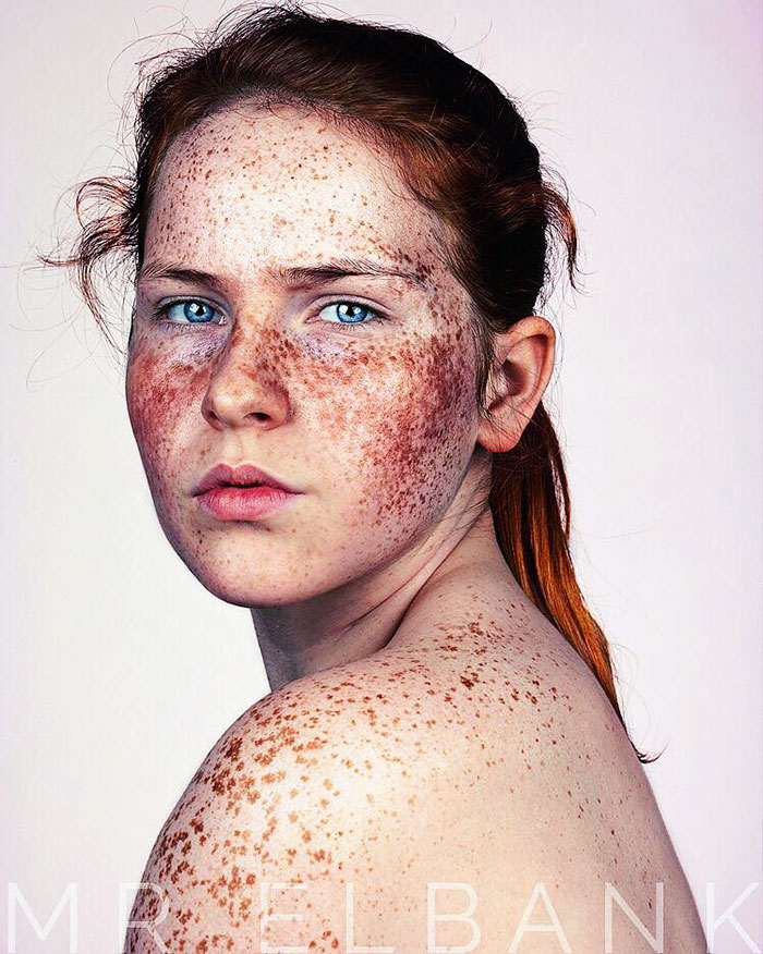 Brock Elbank freckles beauty7