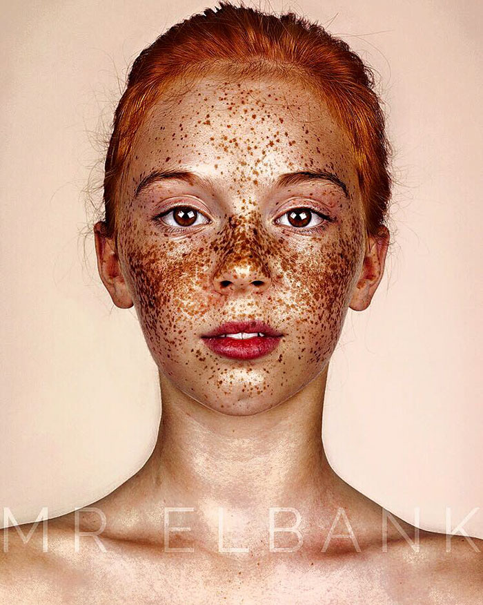 Brock Elbank freckles beauty9