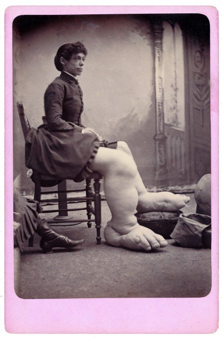 Charles Eisenmann freaks vintage disturbing controversial art8