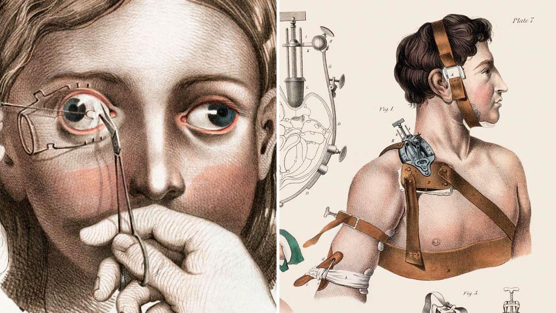 Disturbing Vintage Medical Illustrations Richard-Barnett