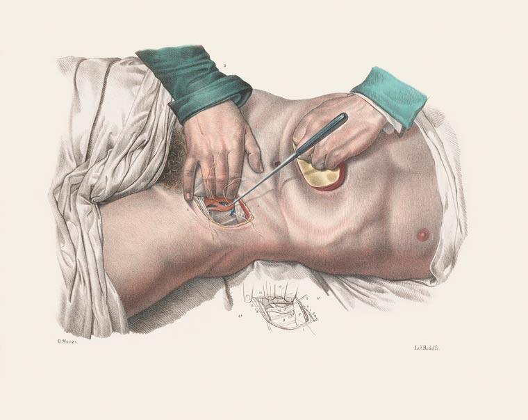 Disturbing Vintage Medical Illustrations Richard-Barnett 10