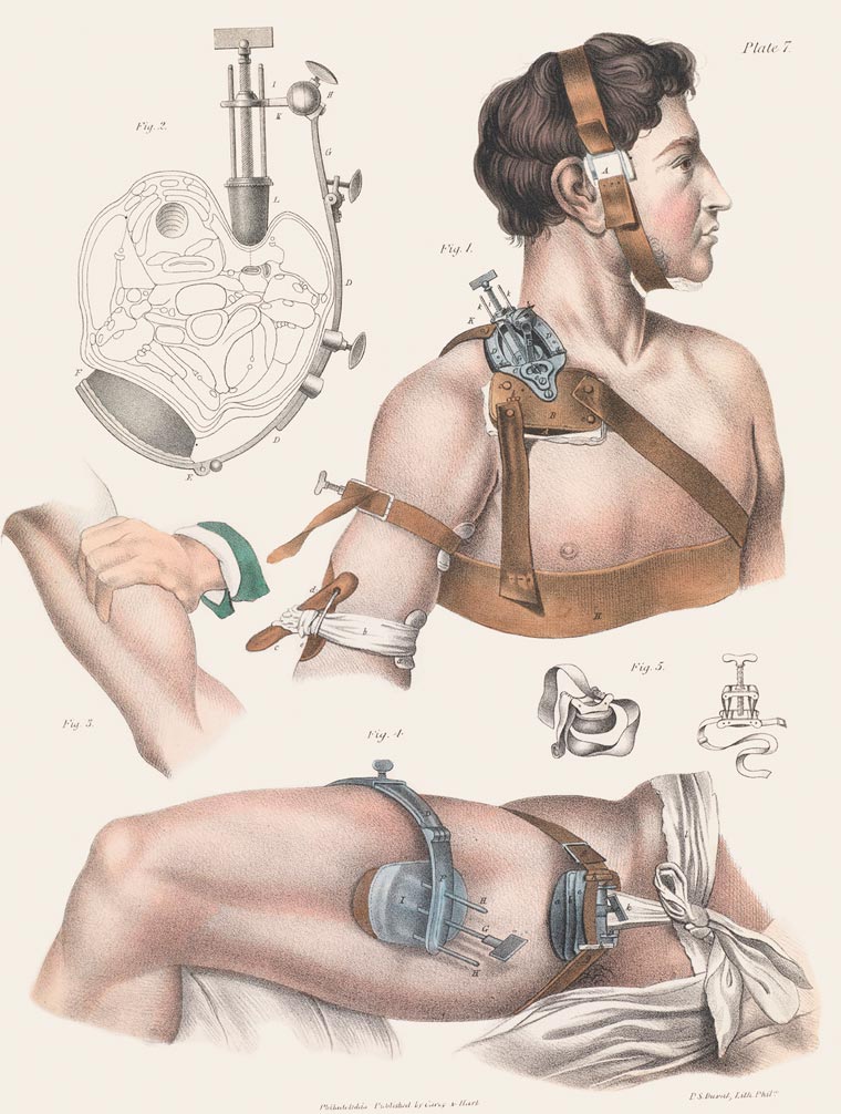 Disturbing Vintage Medical Illustrations Richard-Barnett 13