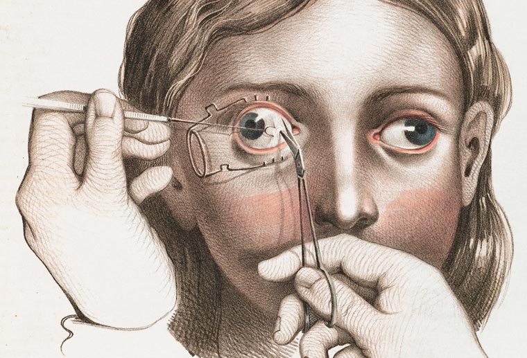 Disturbing Vintage Medical Illustrations Richard-Barnett 14