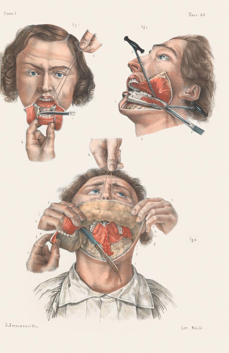 Disturbing Vintage Medical Illustrations Richard-Barnett 3
