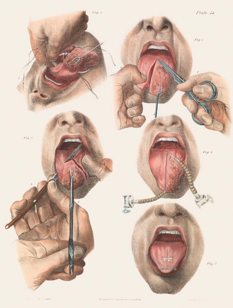Disturbing Vintage Medical Illustrations Richard-Barnett 4