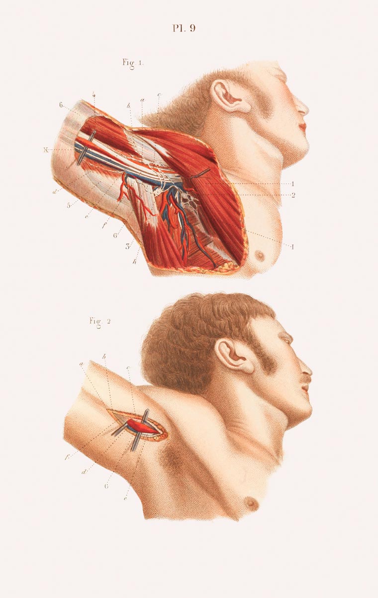 Disturbing Vintage Medical Illustrations Richard-Barnett 6