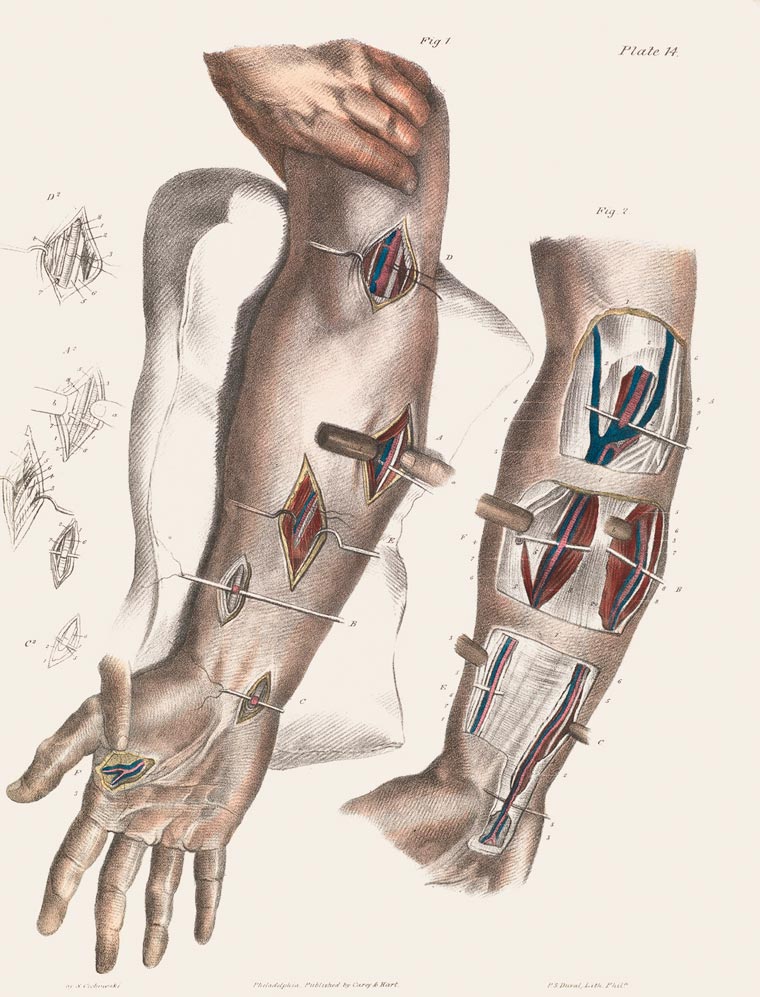 Disturbing Vintage Medical Illustrations Richard-Barnett 8