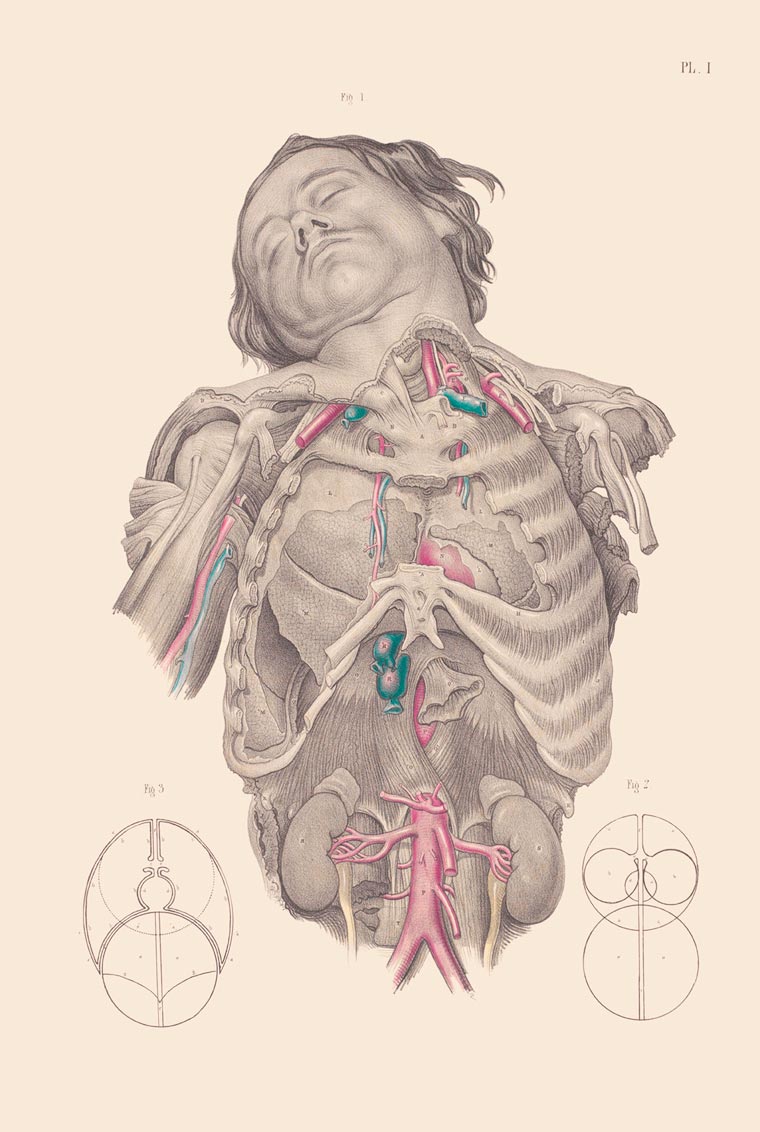 Disturbing Vintage Medical Illustrations Richard-Barnett 9