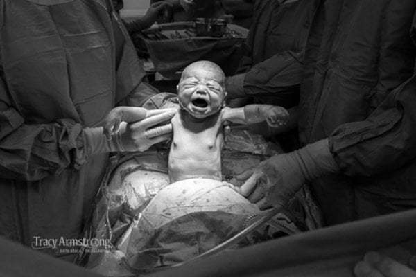 Labor Delivery And Postpartum Photos That Capture The Beauty Of Birth 12