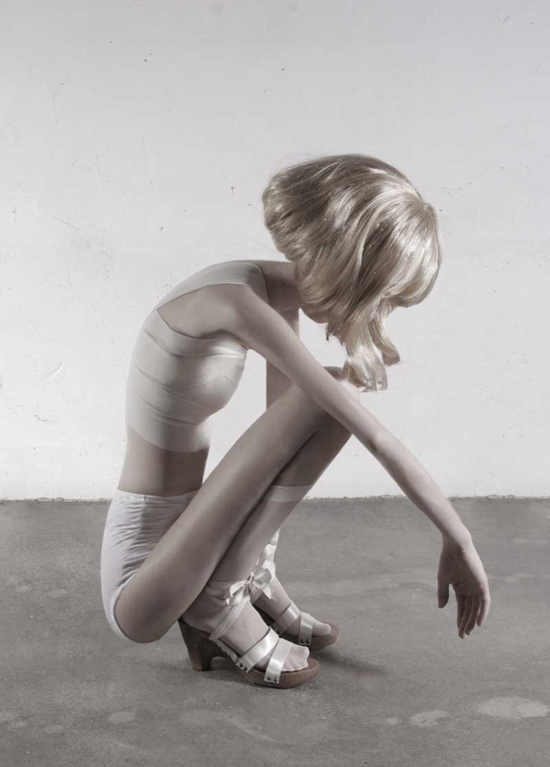 32-KILOS Ivonne-Thein anorexia4