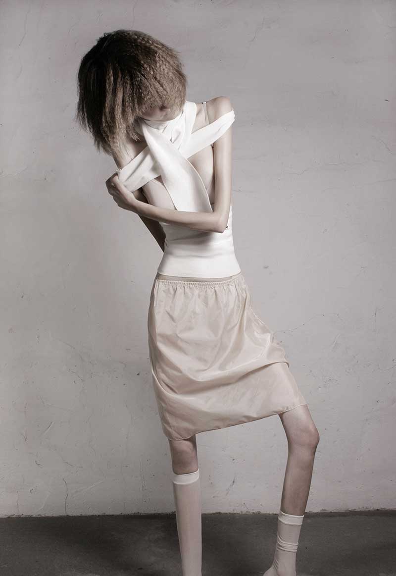 32-KILOS Ivonne-Thein anorexia6