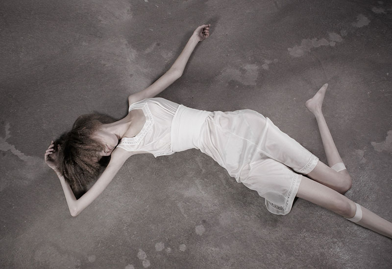 32 KILOS Ivonne Thein anorexia2