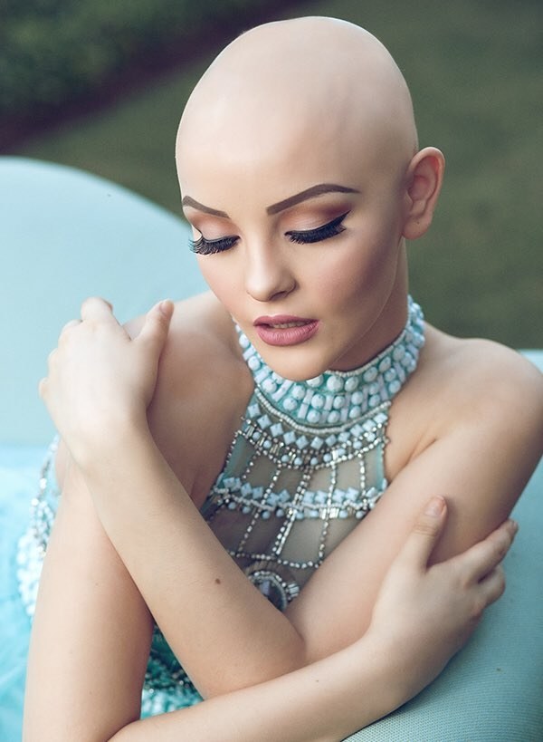 Andrea Sierra Salazar bella modelo cancer 7