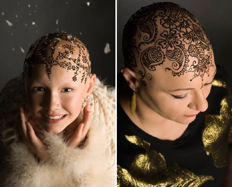 Coronas henna cancer 5