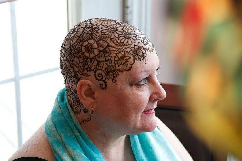 Coronas henna cancer 6