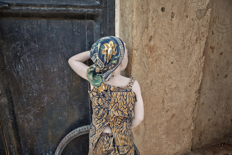 albino culturainquieta11