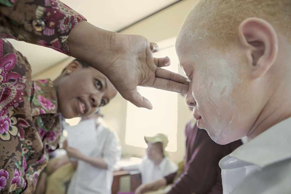 albino culturainquieta3