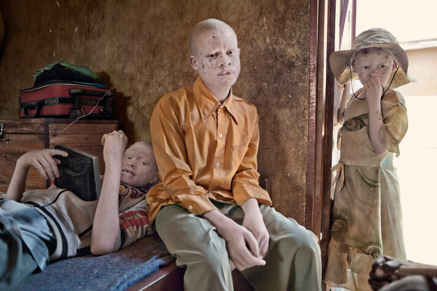 albino culturainquieta6