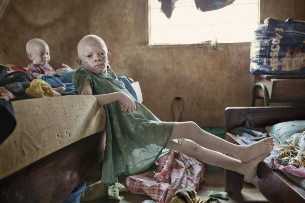 albino culturainquieta8