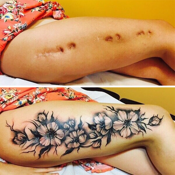 cicatrices marcas tatuajes 1