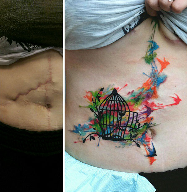 cicatrices marcas tatuajes 10